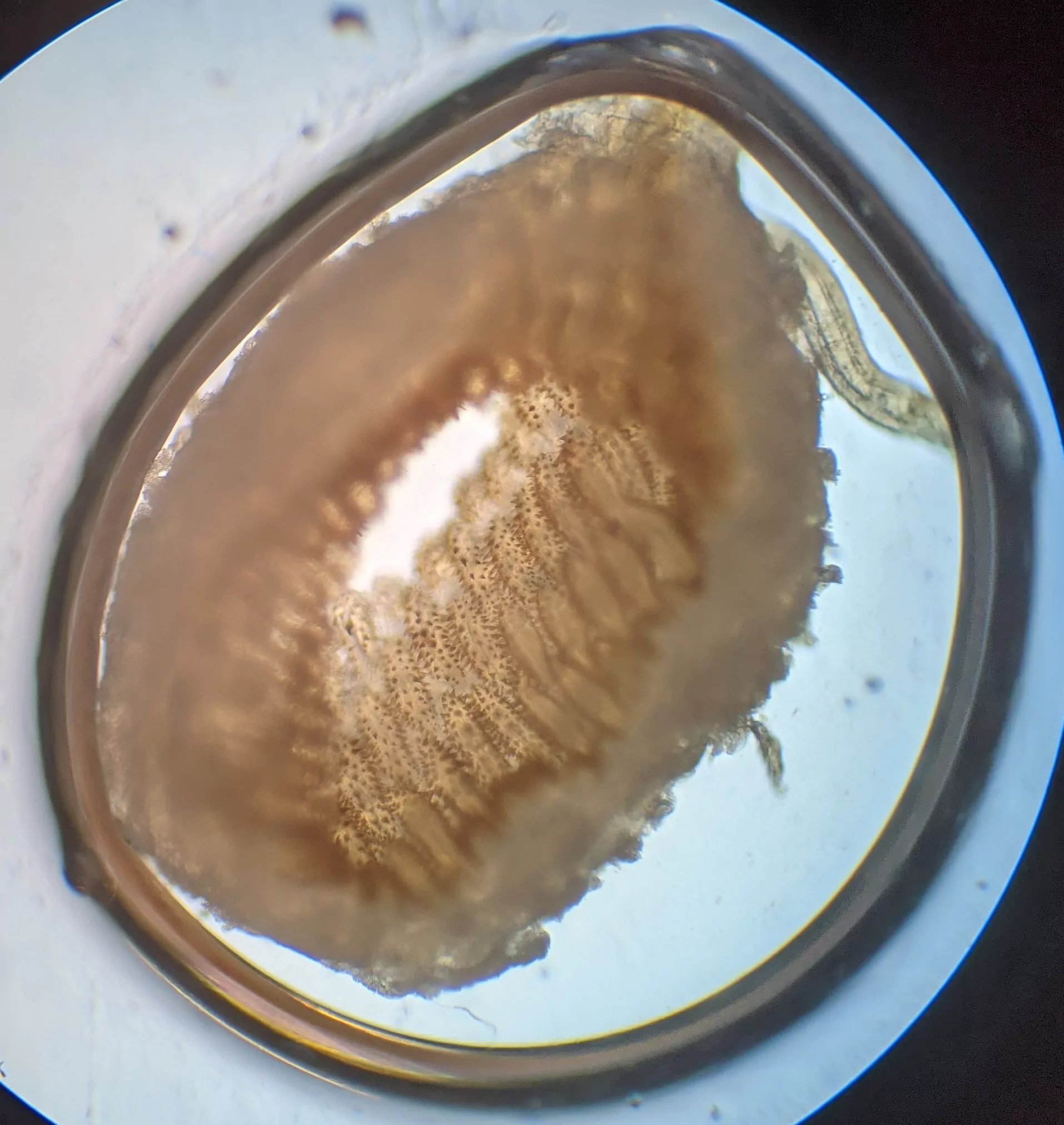 a cross section of the proventriculus of a wax moth larva